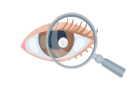 lentes mini esclerales